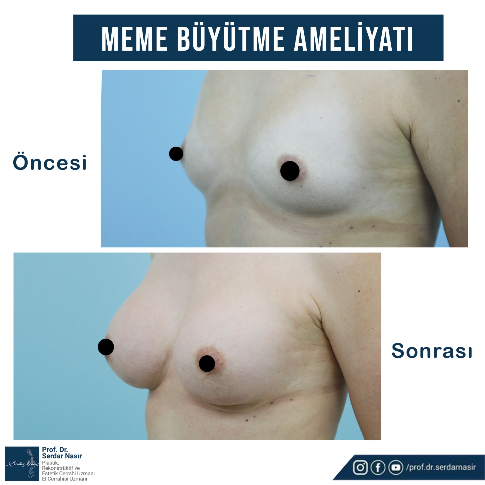 50c2e331-a15f-4977-bde2-3e46a10a93b9