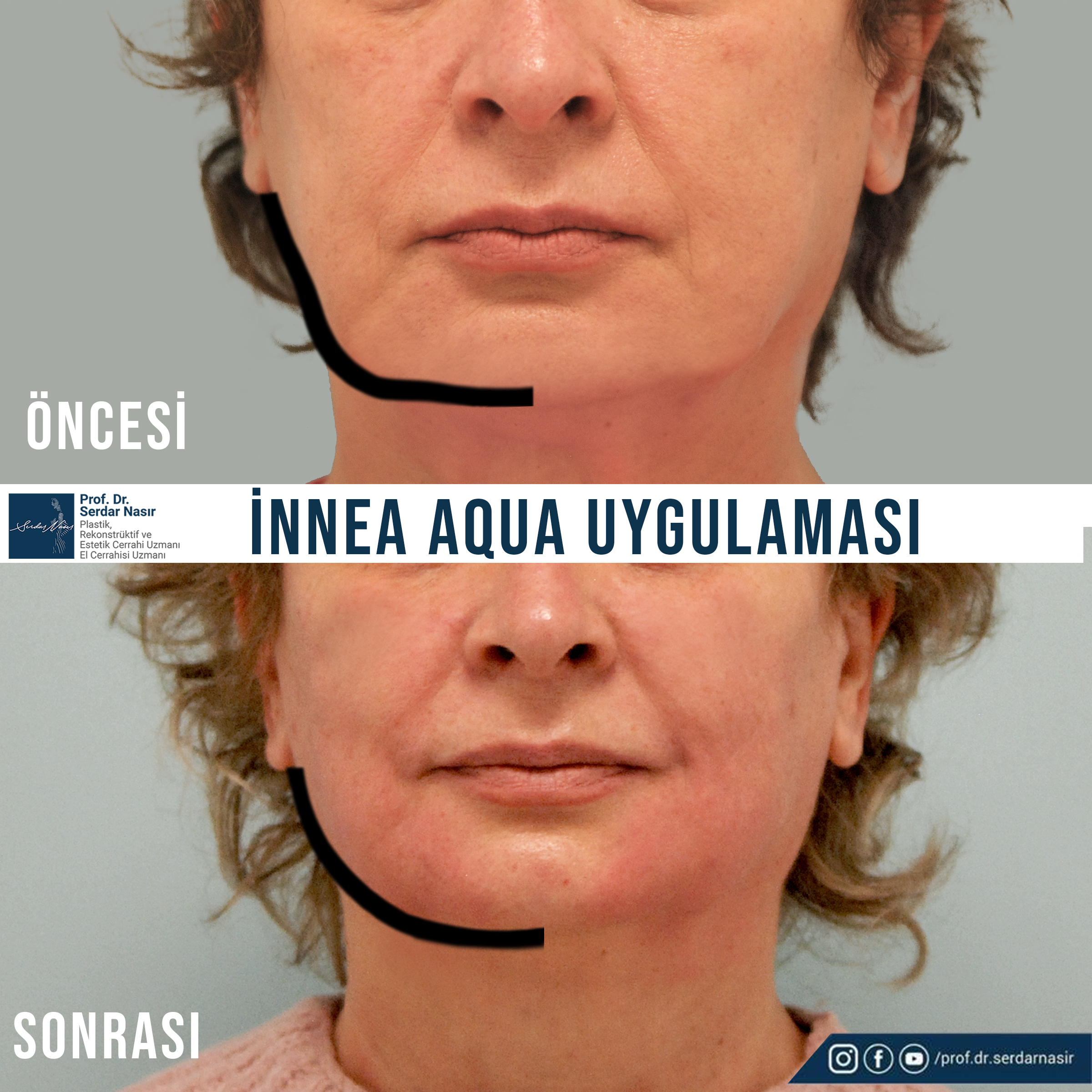 Untitled-2-Recovered