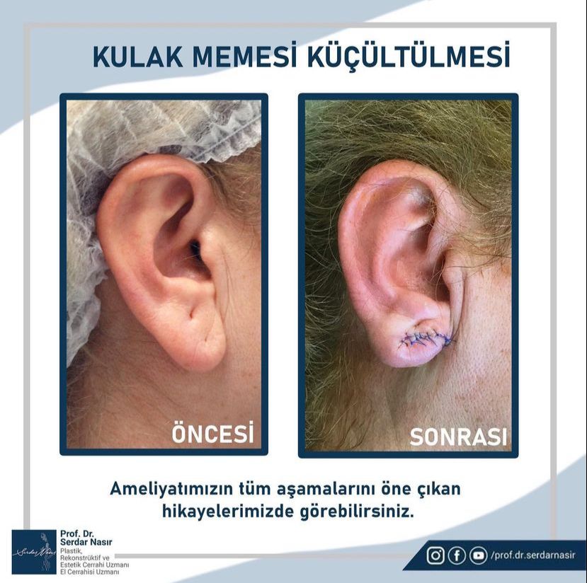 WhatsApp Image 2022-03-18 at 13.17.28