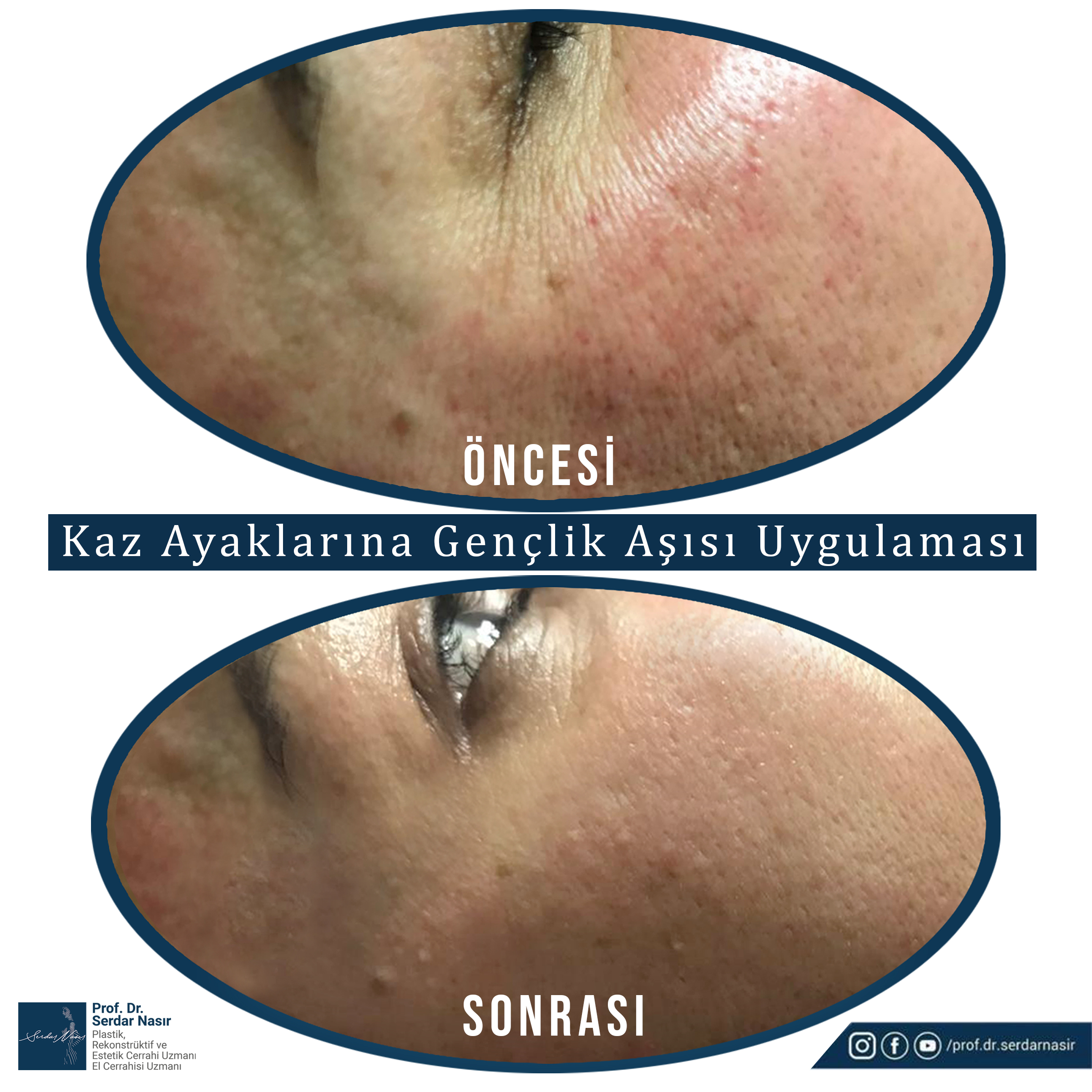 gençlik aşısıııı