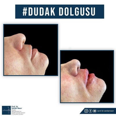 WhatsApp-Image-2021-11-08-at-23.35.53-1