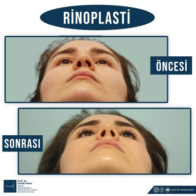 WhatsApp-Image-2021-11-08-at-23.36.38