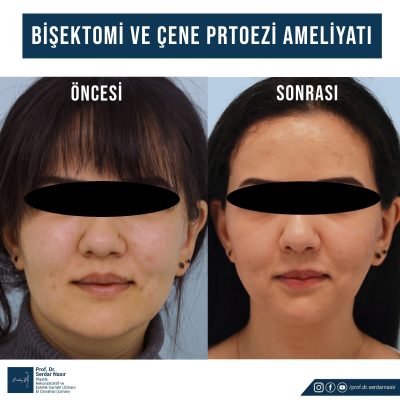 f4b7d51a-e914-4b6d-9676-44c187dfa9b2